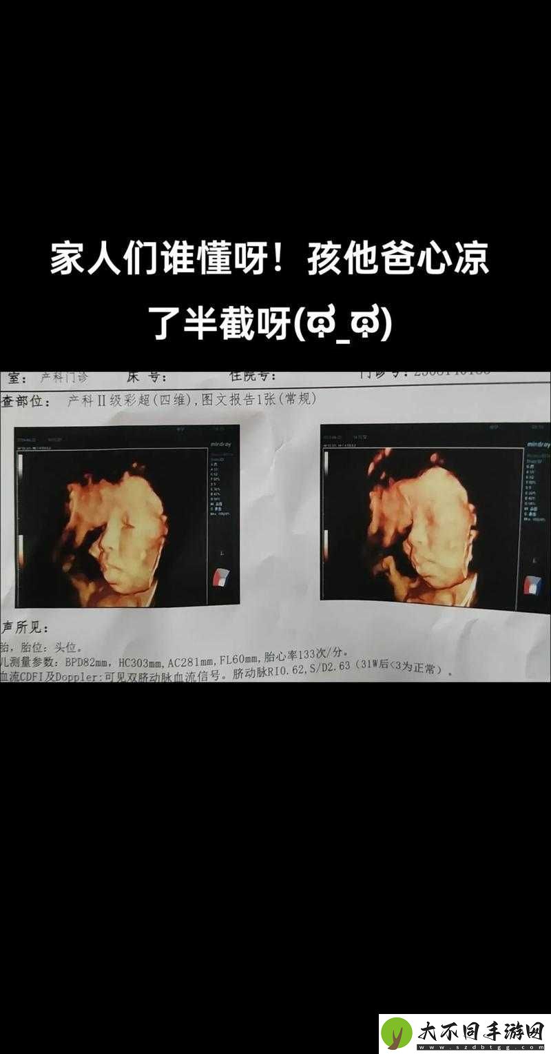 怀孕晚期，医生每次都问做四维，你知道原因吗？