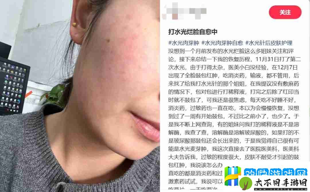 扎堆修复“烂脸”的年轻人，带火了医美新赛道