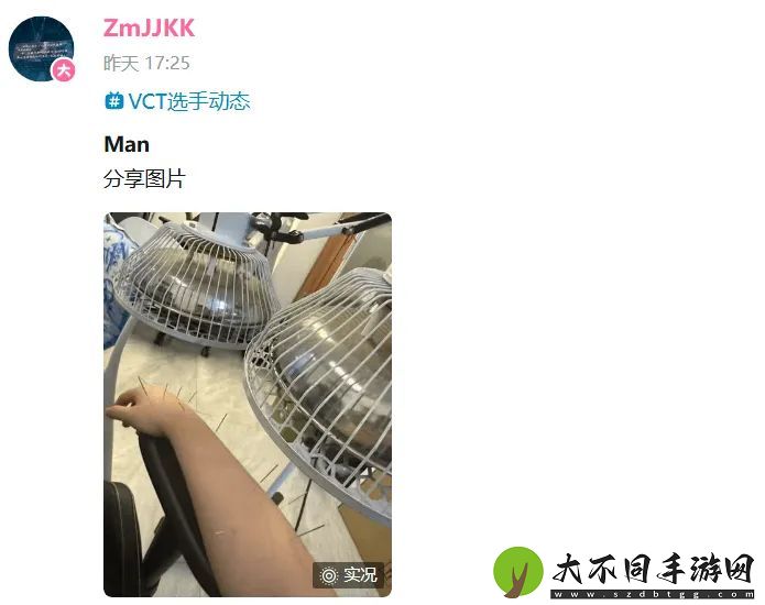 快点恢复哇！ZmjjKK选手分享针灸理疗照片